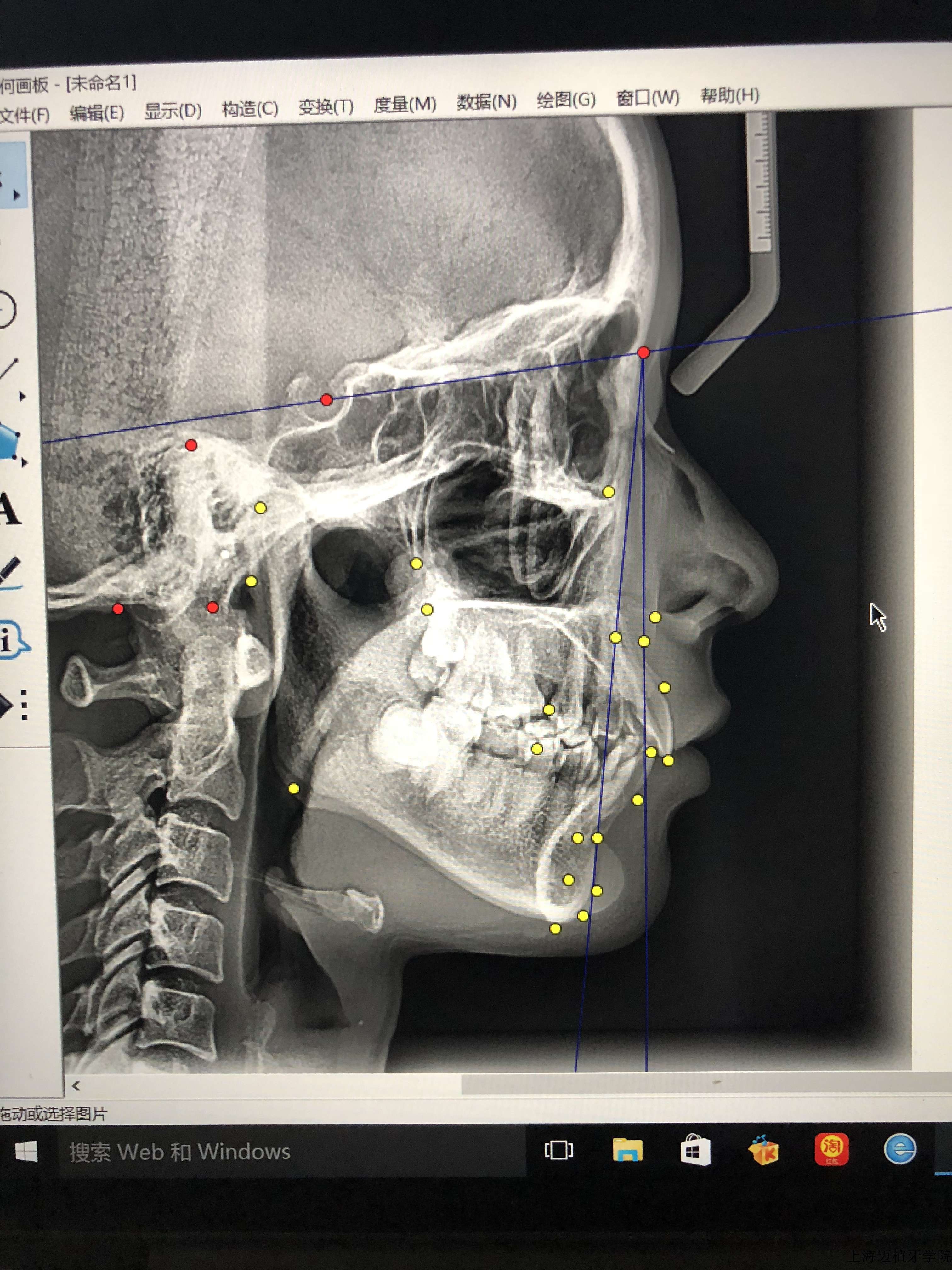 精准头影测量与诊断设计操作记武广增系统班第二天附正畸治疗同意书